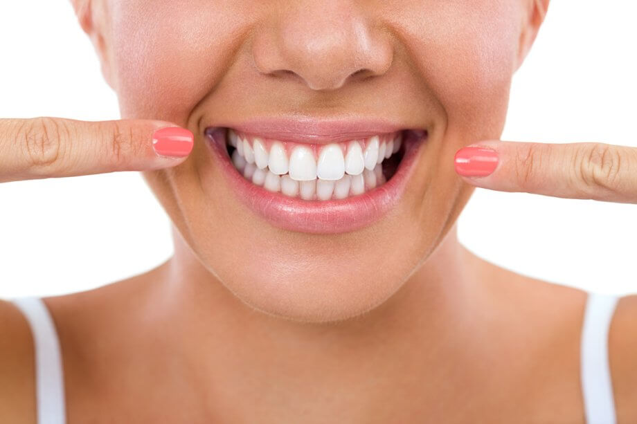 3 Options For Whitening Your Teeth
