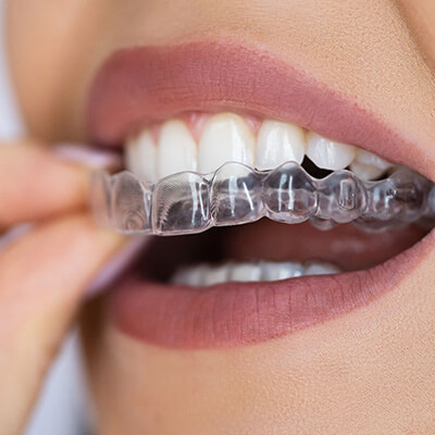 Invisalign in Westford, MA