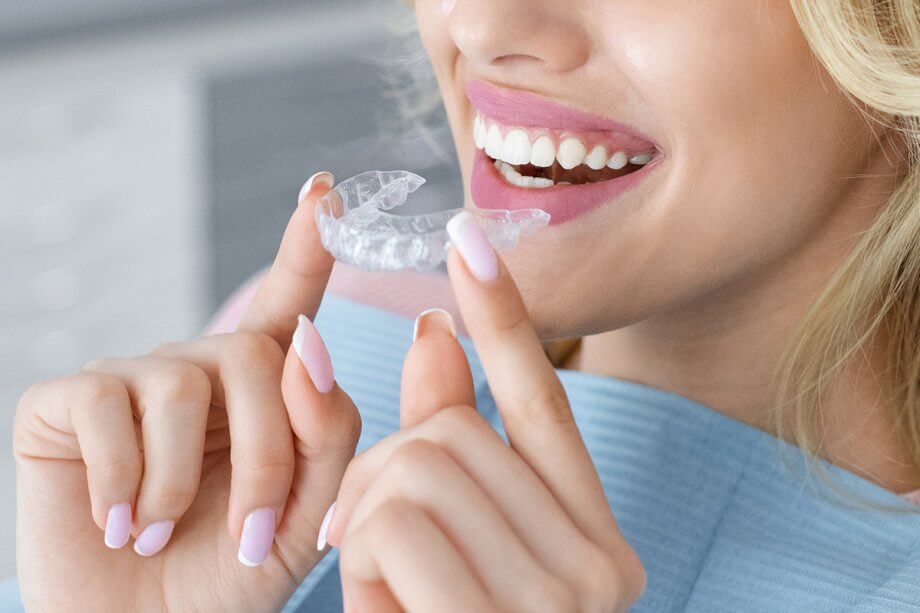 Clear Aligners vs