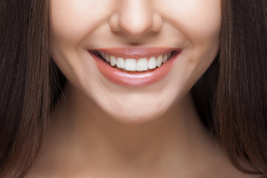 How Long Does Teeth Whitening Last?